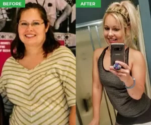 ElectroSlim before and after